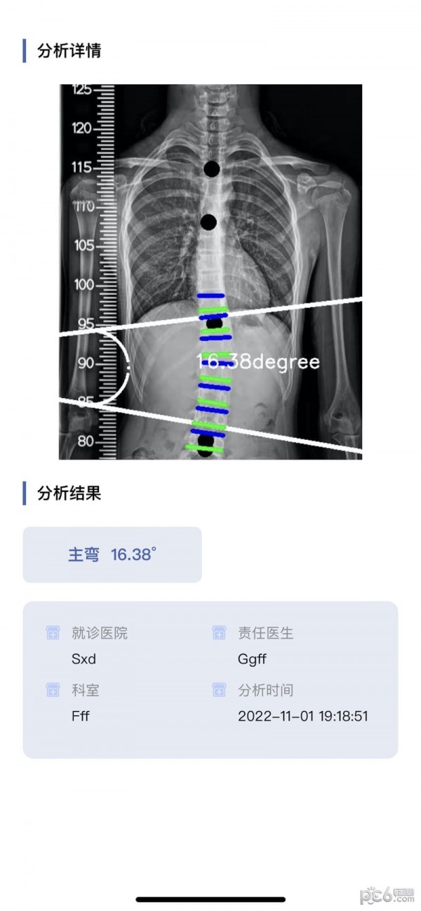 筠成矯形界面展示2